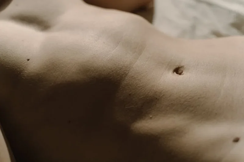 표피낭종 수술