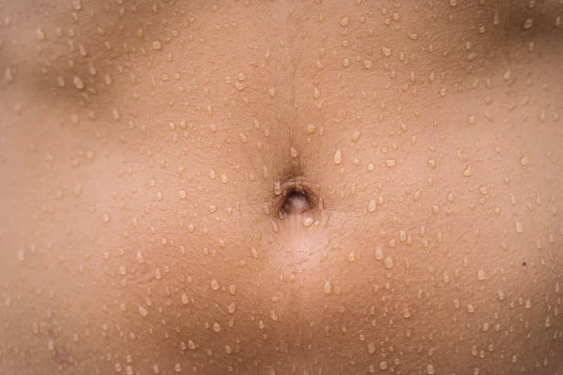 표피낭종 수술