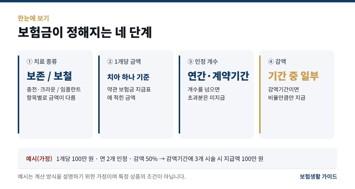 보험금 결정 단계 요약: 치료 종류, 치아 1개당 금액, 연간과 계약기간 인정 개수, 감액 적용